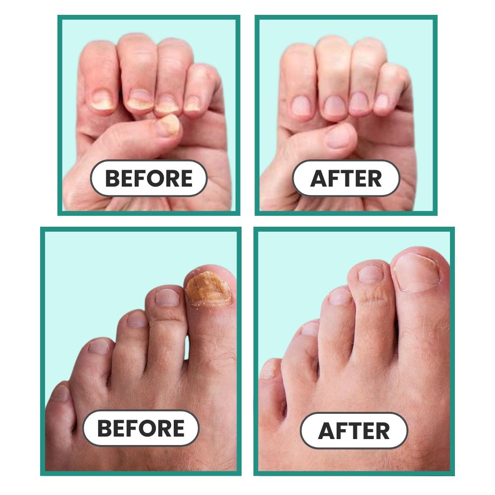 OrthoVital Anti-Fungal Cream